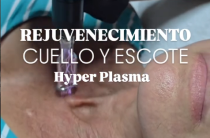 Tratamiento clínico estético para el rejuvenecimiento y firmeza de cuello y escote en Vieques.