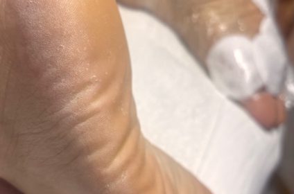 Proceso de aplicación de mascarilla y envoltura hidratante para talones agrietados en NO FILTER Skin & Beauty Gurabo PR.
