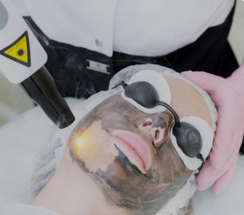 Hollywood Peel Offer